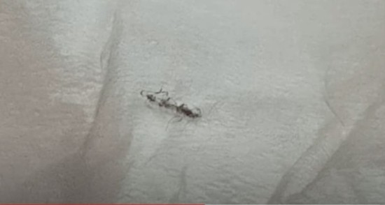 [한 가족의 실제 현상] 몸 속에서 이상한 게 나올 때 대처법 