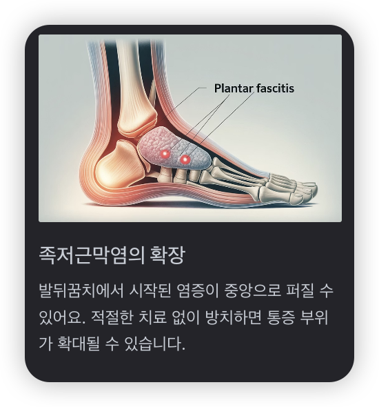 발바닥-중앙-통증-족저근막염-확장