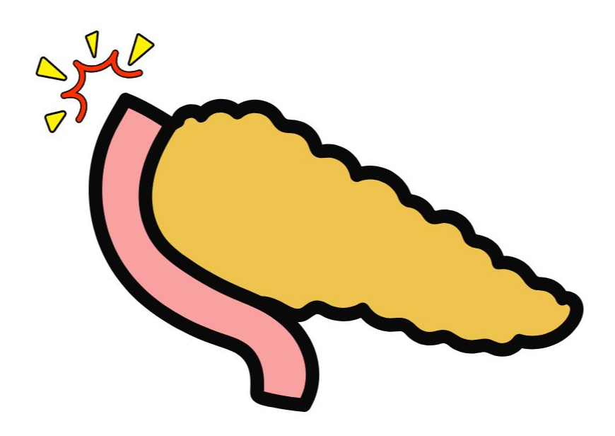 췌관 확장