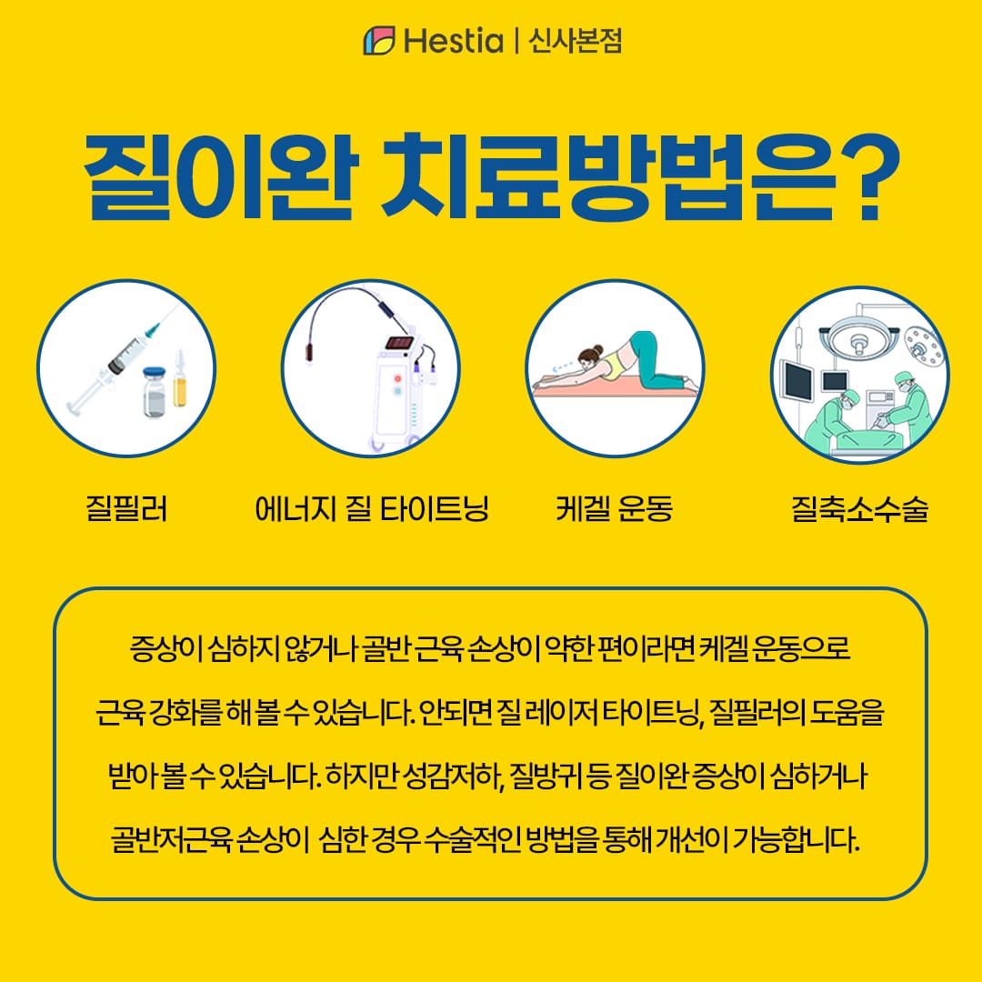 출산후 질이완 치료방법은?