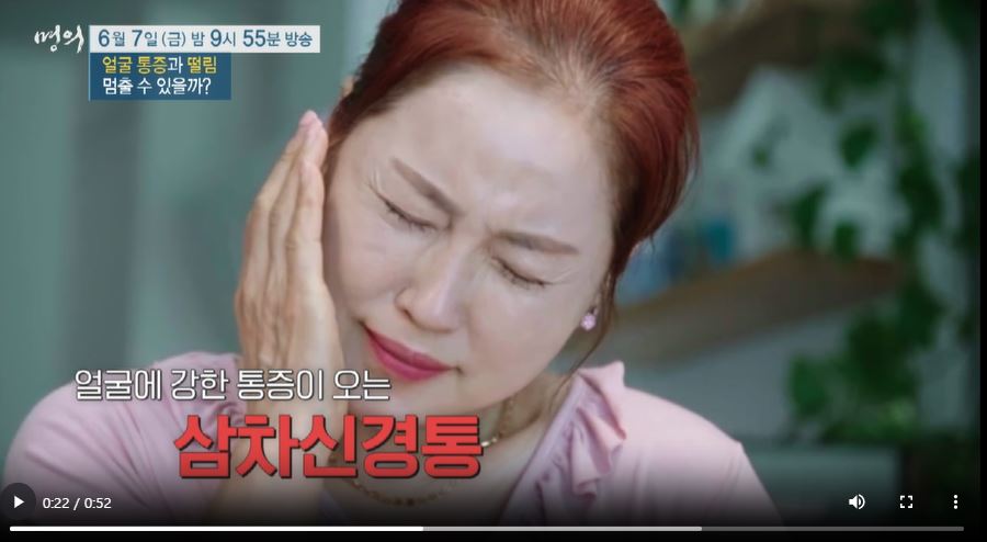 EBS 명의 삼차신경통 원인 증상 치료