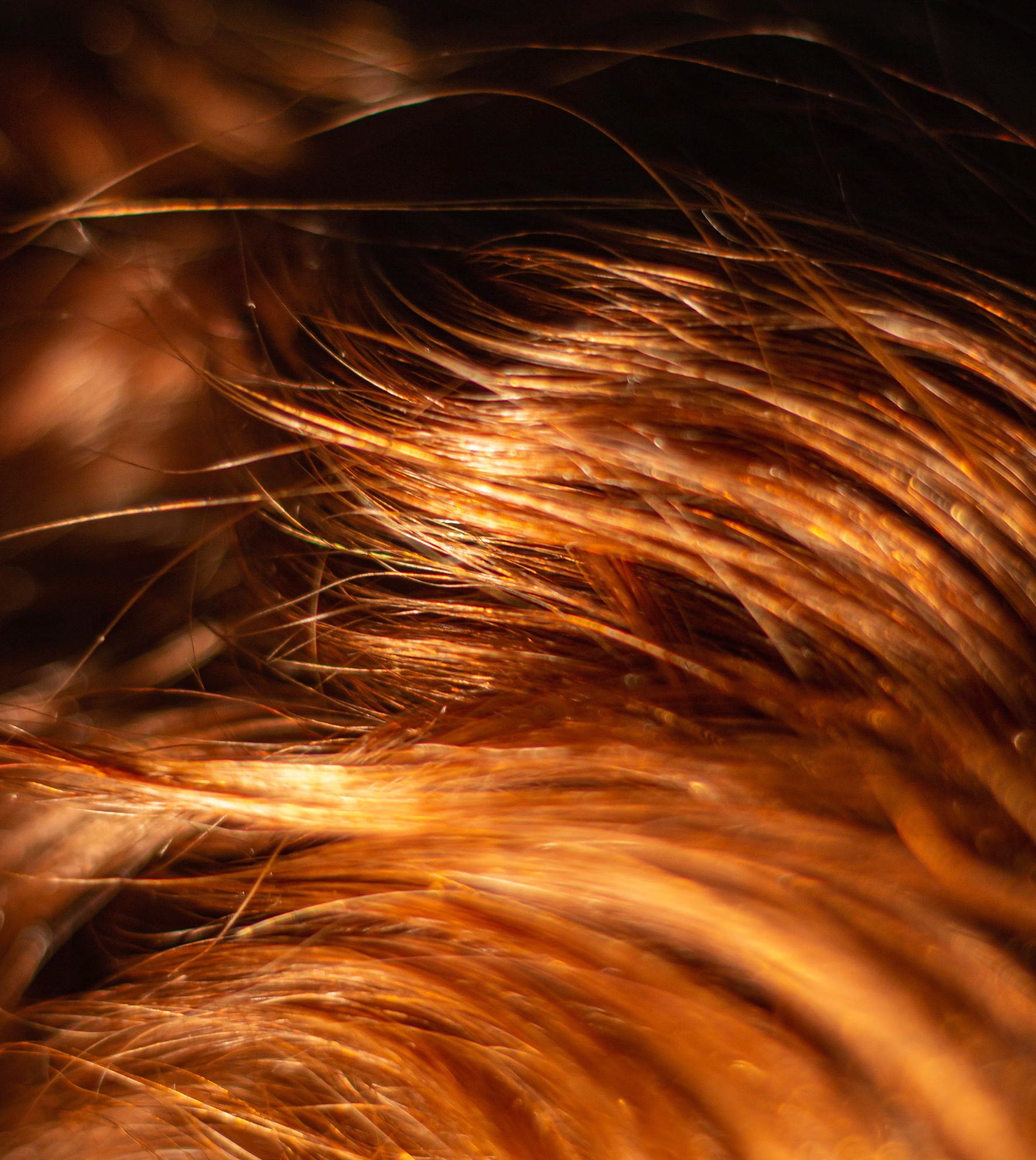 두피 모낭염 연고