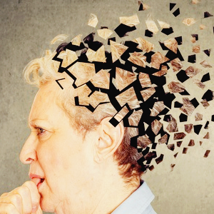 알츠하이머 치매 관련주 대장주 TOP10