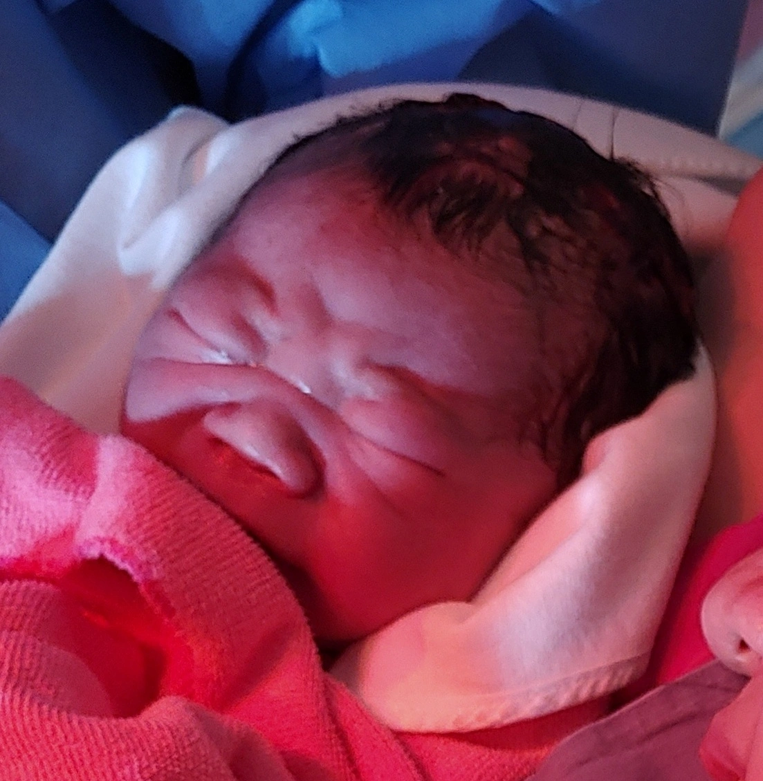 신생아 태변 먹으면 괜찮나요..?(태변흡인증후군)