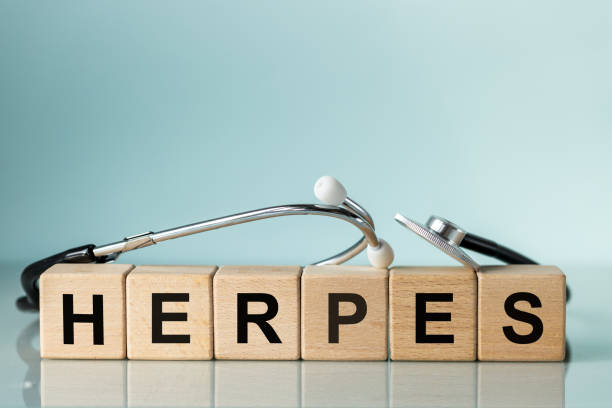 헤르페스 2형 단순 포진 바이러스 증상