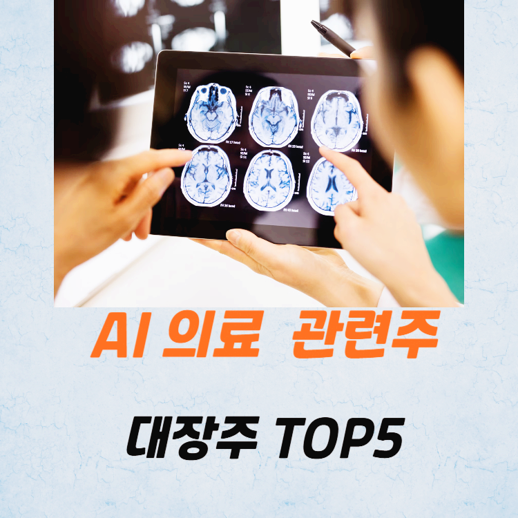 AI 의료 관련주 대장주 테마주 TOP5