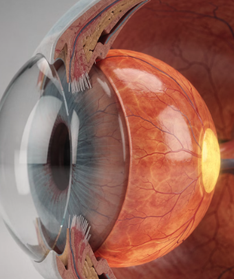 황반변성 손상 과정