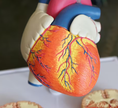 고지혈증 증상 원인 예방법 음식