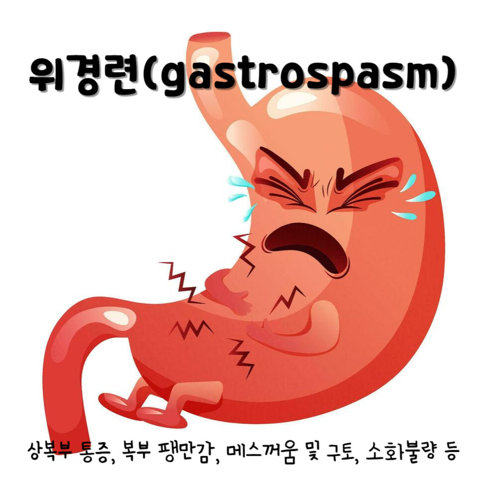 위경련(gastrospasm)
위경련 주요 증상 : 상복부 통증, 복부 팽만감, 메스꺼움 및 구토, 소화불량 등