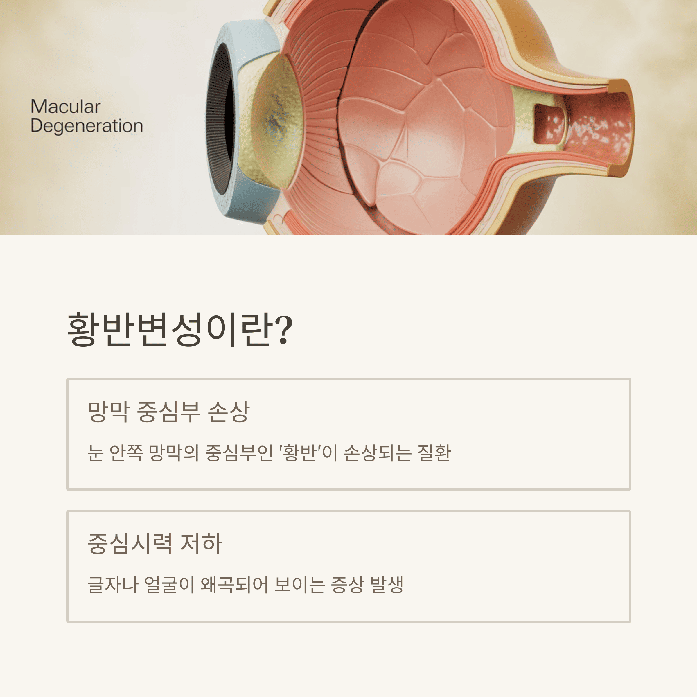 중년 황반변성! 실명 위험 낮추는 7가지 핵심 전략