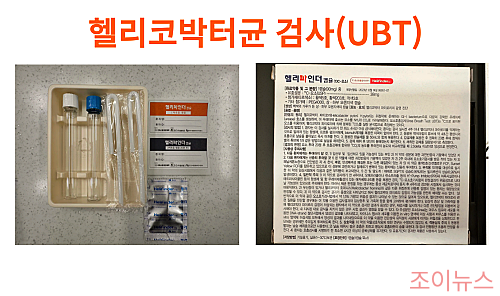 UBT(요소 호흡검사): 내시경 X