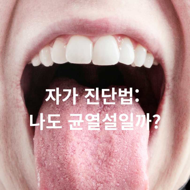 혀 갈라짐의 원인과 대처법