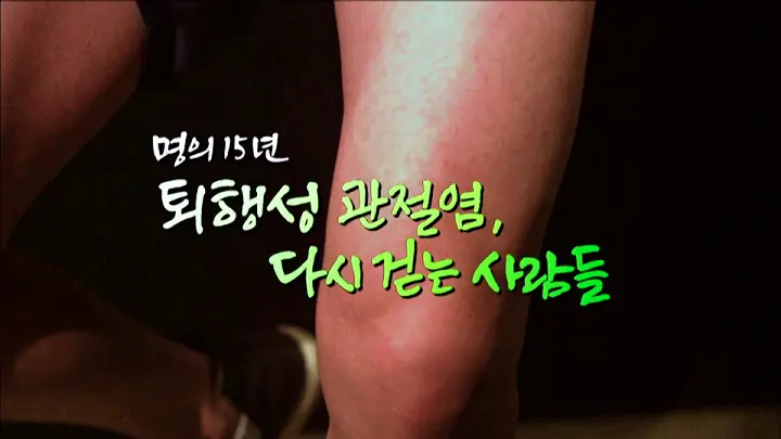 명의 무릎 퇴행성 관절염 배대경 교수 전화 및 온라인 예약