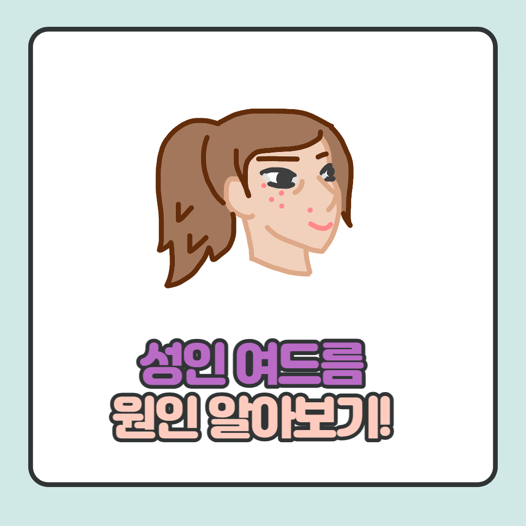 성인-여드름-원인