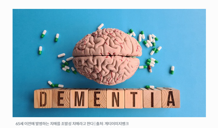 치매 초기 증상, 가족이 꼭 알아둬야 할 7가지 신호