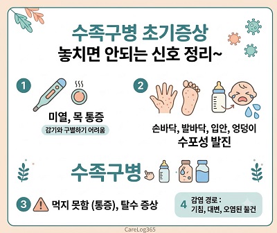 수족구 병 초기현상설명