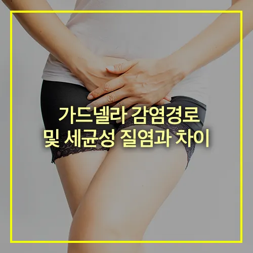 가드넬라 감염경로 세균성 질염과 차이 썸네일