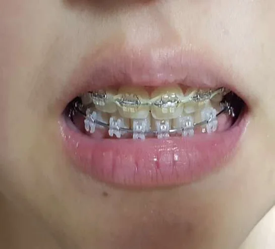 미소만들기치과의원