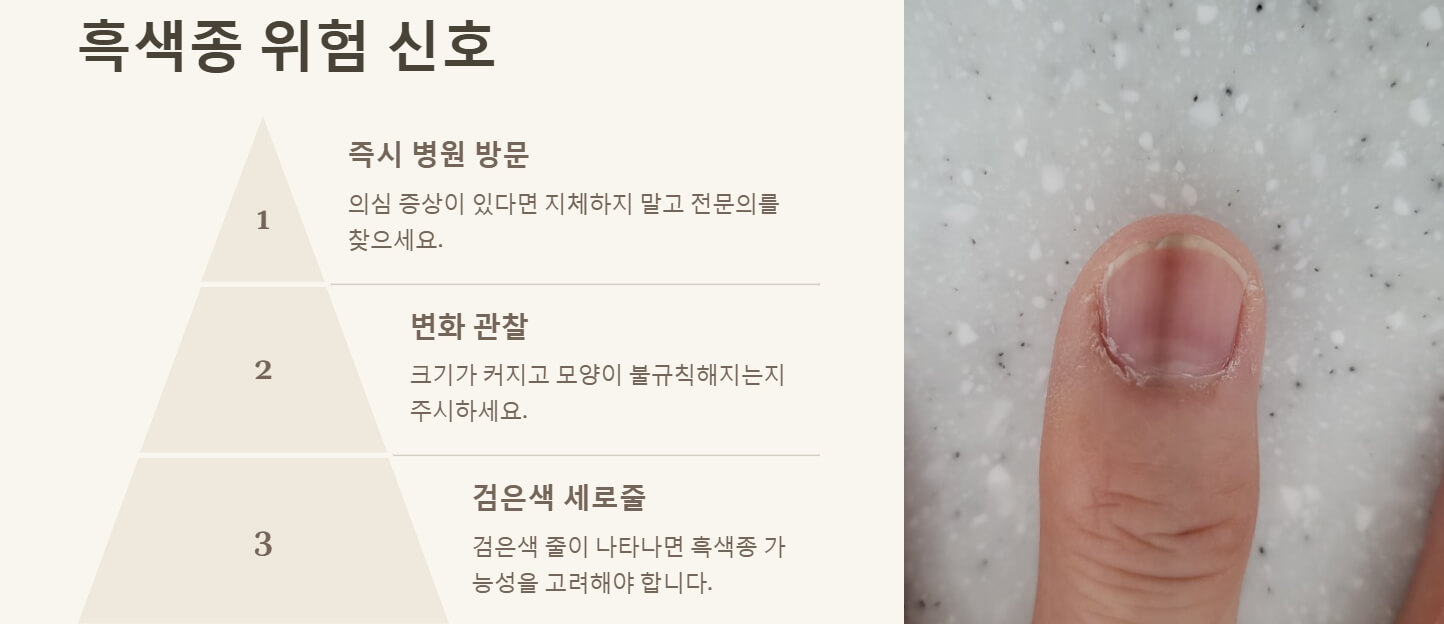 손톱에 세로줄이 생기는 이유