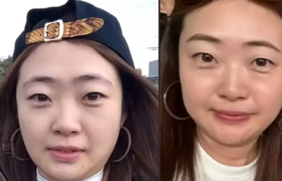 정숙 요즘 얼굴