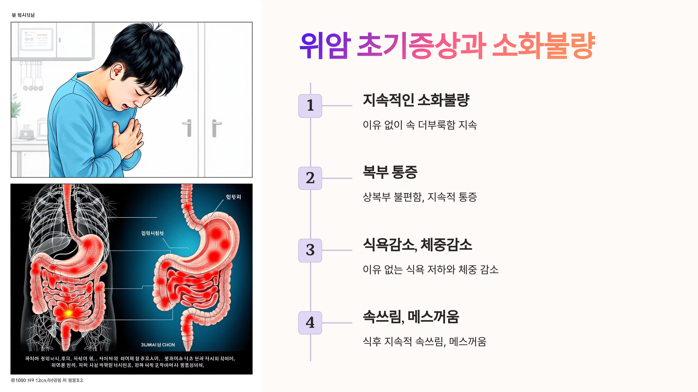 위암 초기증상과 소화불량