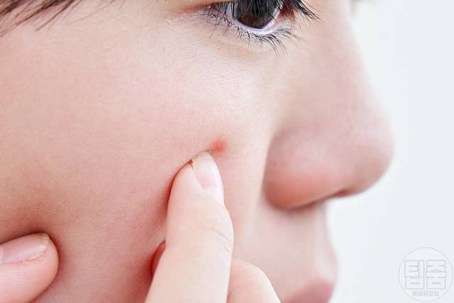 얼굴 노화 증상,피부노화 증상,피부 재생 크림