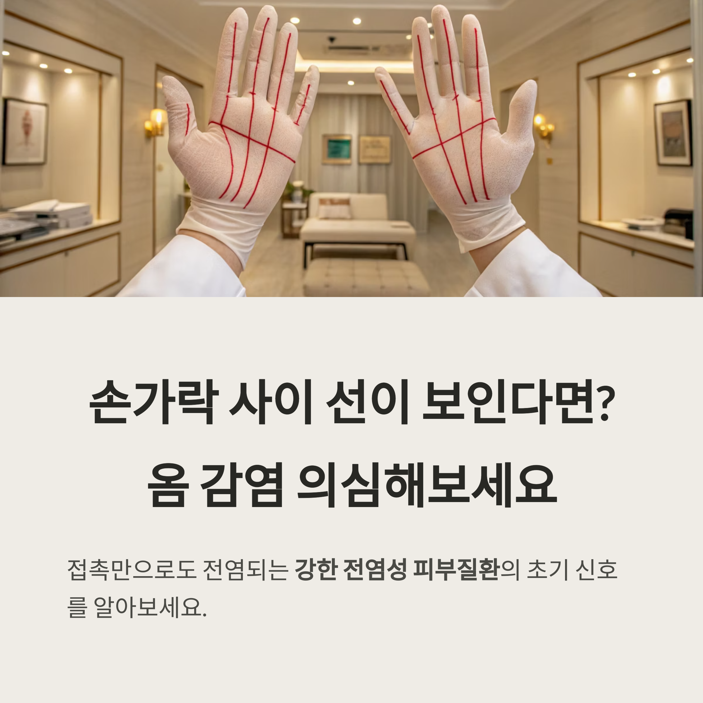 옴 초기증상