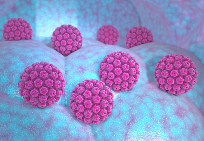 hpv 바이러스 원인