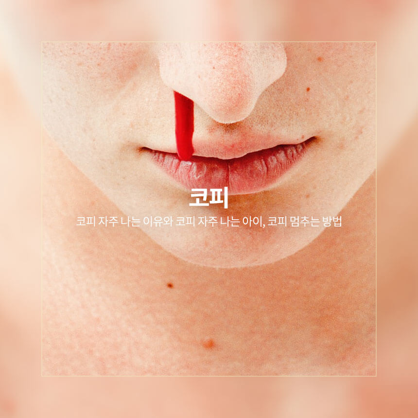 “코피-자주-나는-이유-코피-멈추는-방법”