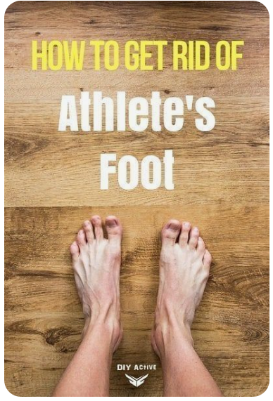 무좀의-원인과-증상