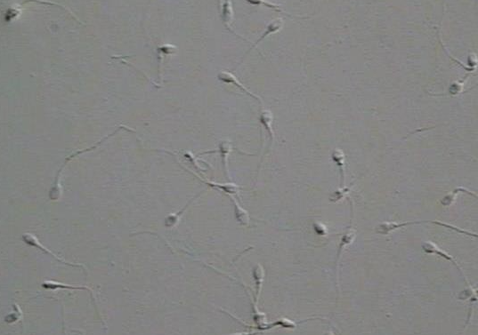 시알리스, 팔팔정, 무정자증 가능성 있다는 거 아시나요?