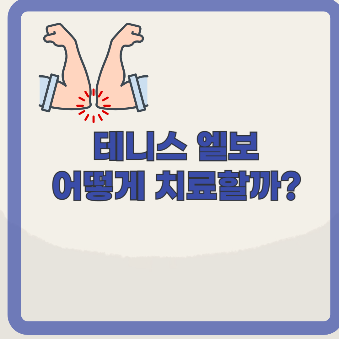 일상 속 팔꿈치 통증, 테니스 엘보의 예방과 관리 팁