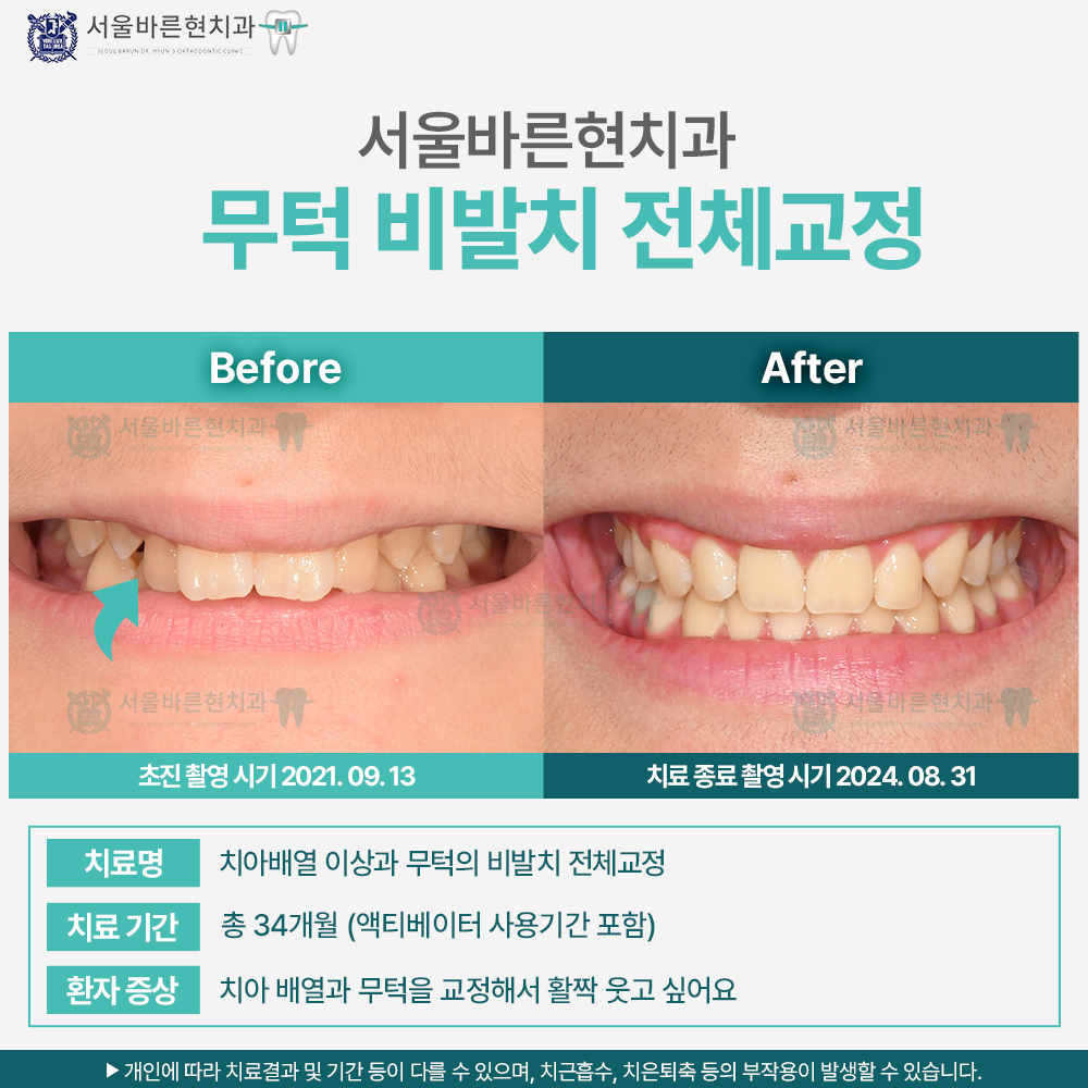 해운대교정치과