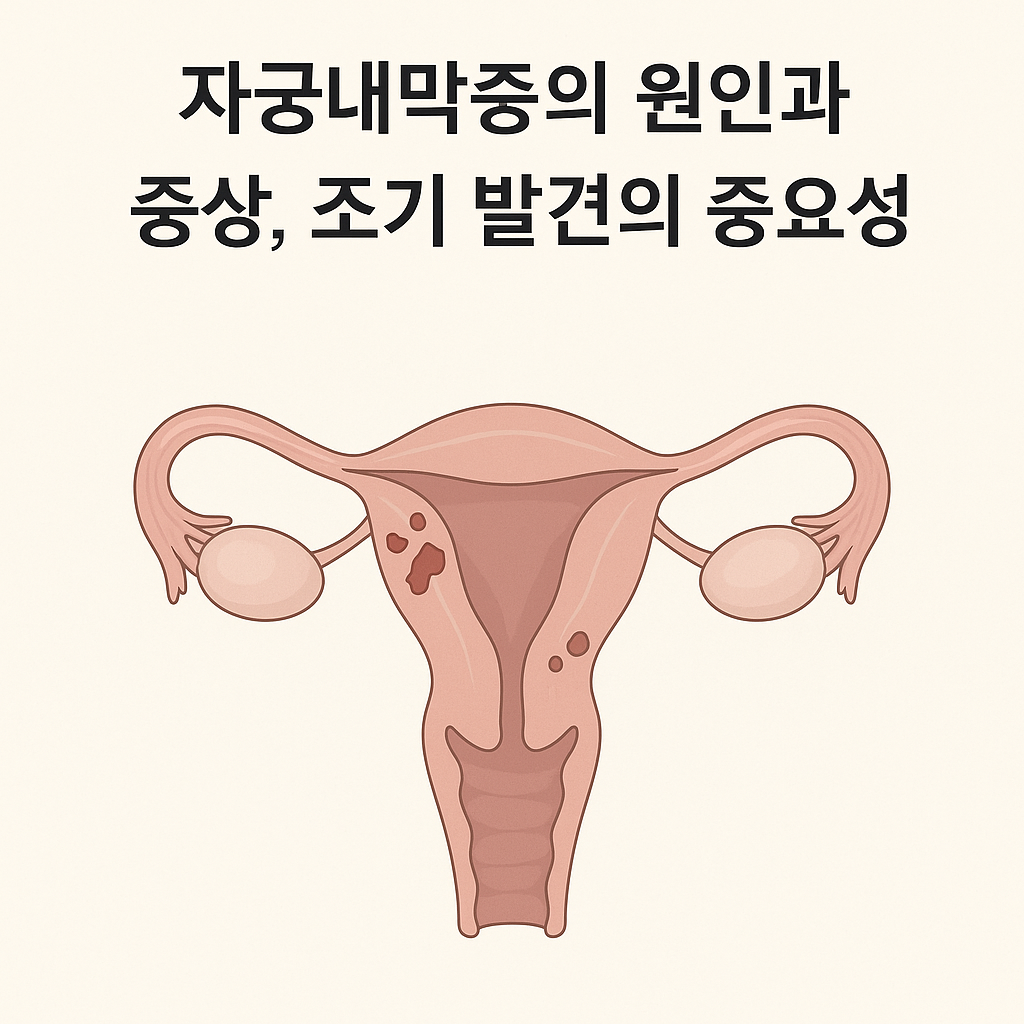 자궁내막증의 원인과 증상, 조기 발견의 중요성