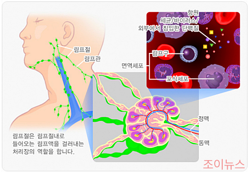 목 부음과 림프절염의 관계_이미지출처: 국가건강정보포털