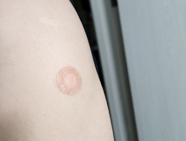 비형간염-예방접종-주사부위-왼쪽팔