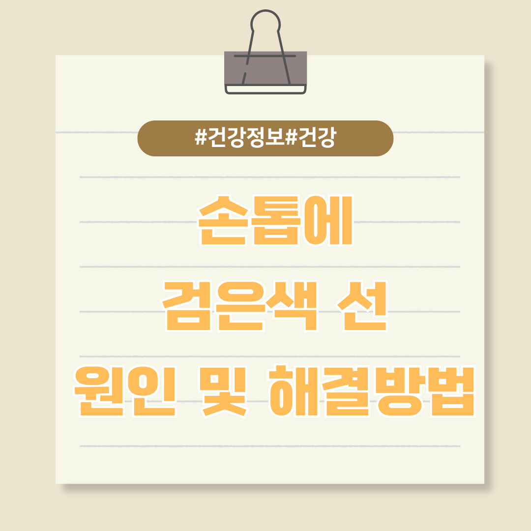 손톱에 검은색 선이? 원인 및 해결방법 알아보기