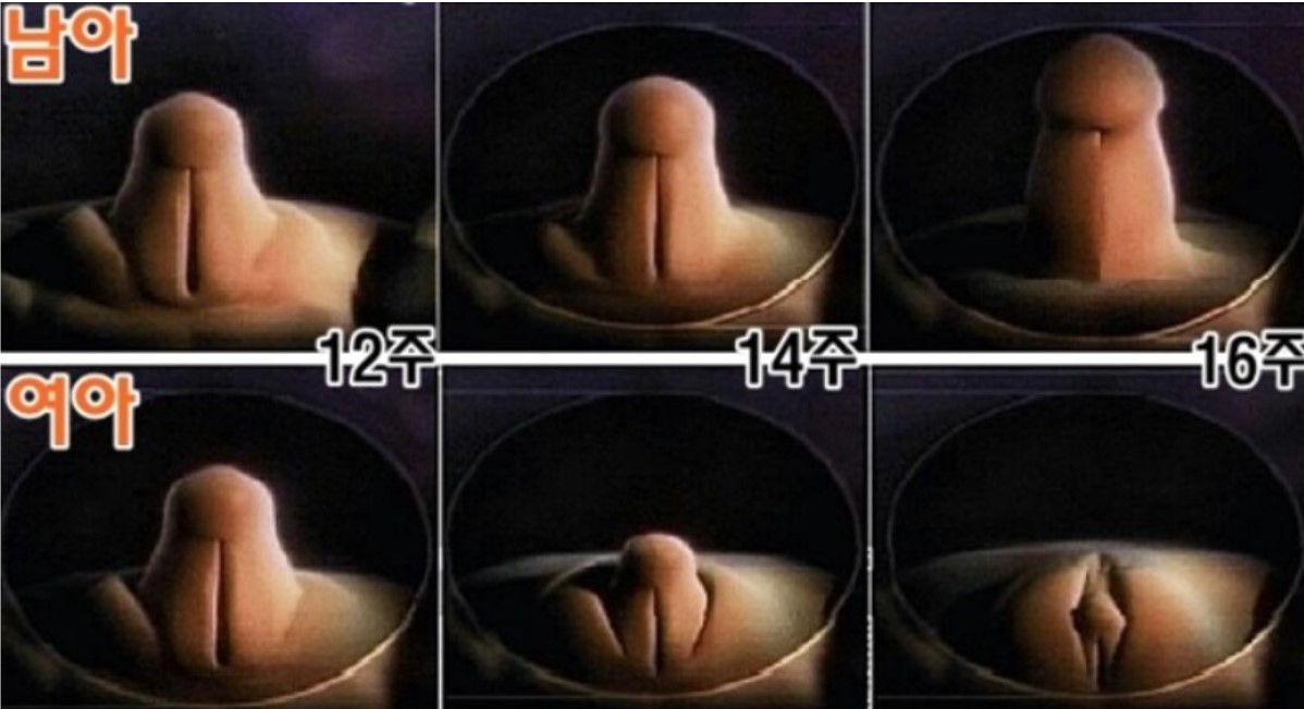 태아 성별 시기