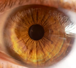 녹내장 치료법 진단 기준 합병증