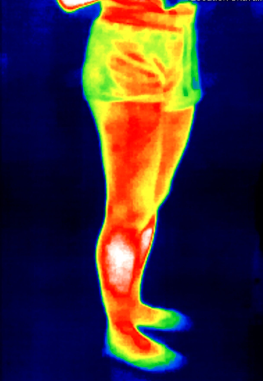 체온 상승이 면역력에 미치는 영향 관련 사진