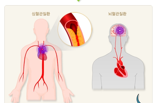 대사증후군 안내문