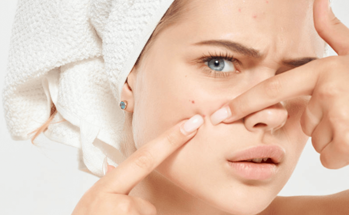 피부혹 양성종양 종류와 치료 방법