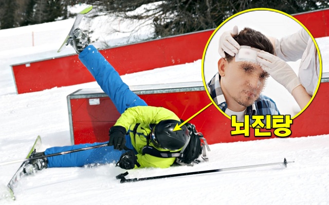 뇌진탕 증상 어지럼증 기억력 저하, 건강 팁줌 매일꿀정보