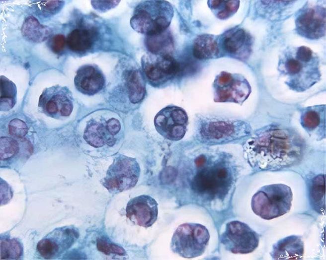 호중구 정상수치