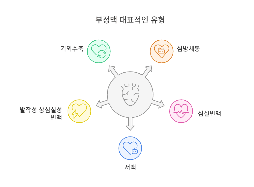 부정맥 대표적인 유형