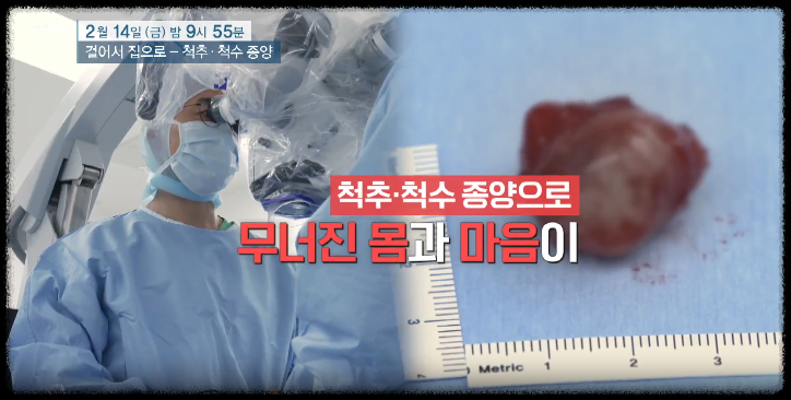 척추척수 종양