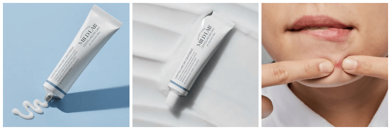 마일드랩 센텔라스카 연고, 여드름 압출 사진