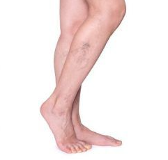 종아리혈액순환