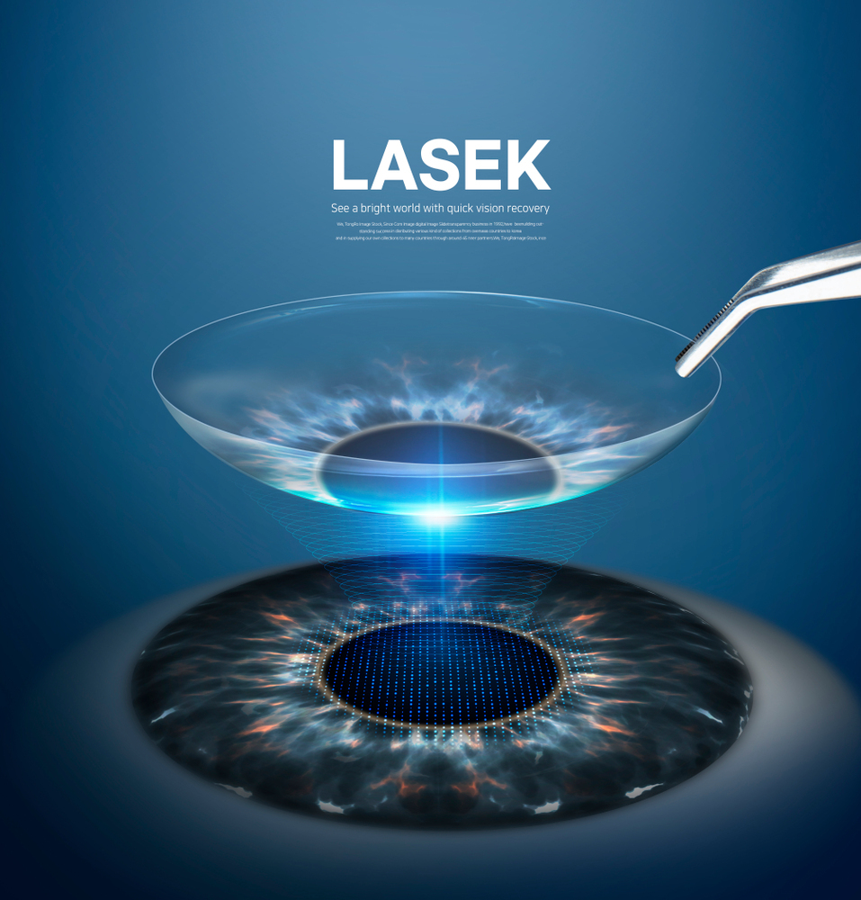 라식과 라섹 차이점 (개인 경험담)