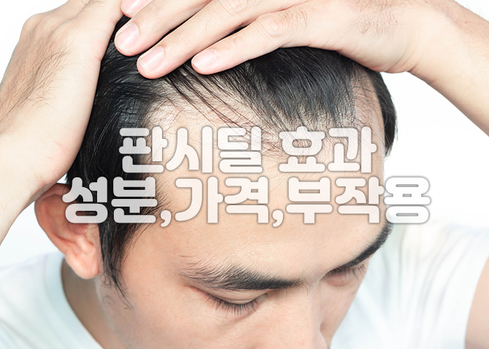 머리가 많이 빠진 남성이 머리를 뒤로 넘기고 있다